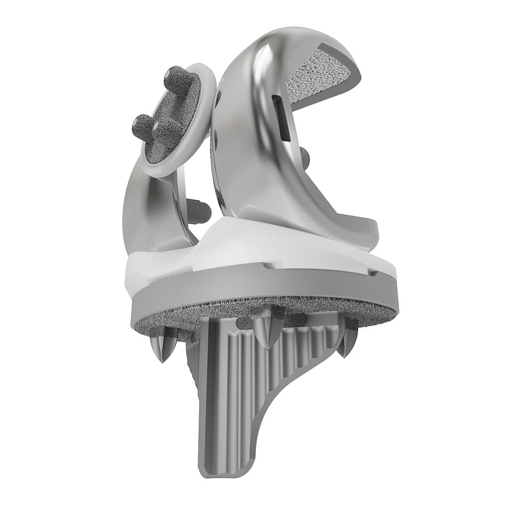 Orthopedic Implants